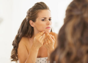 FAQ Acne Vrouw over 20 met acne acne bij oudere vrouw