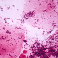 Bacteriële vaginose