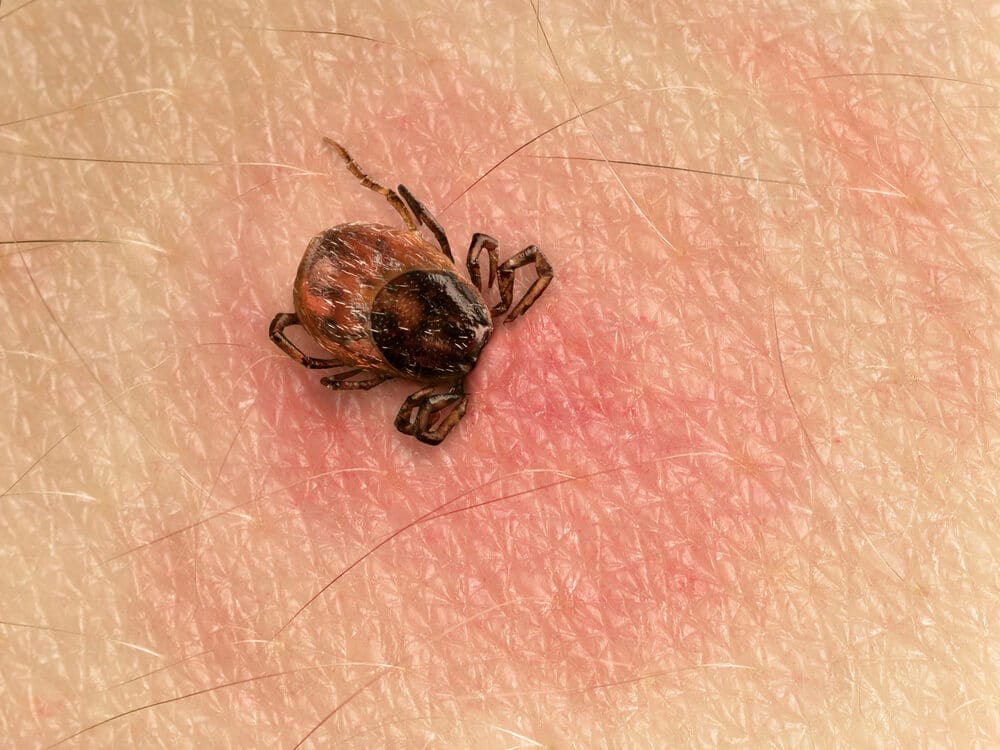 Toename ziekte van Lyme door tekenbeten