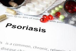 faq-psoriasis-te-genezen