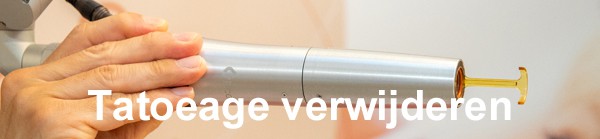 BANNERLINK Tattoo verwijderen