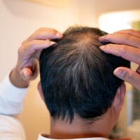 Man,Checks,Thinning,Hair,In,Front,Of,A,Bathroom,Mirror