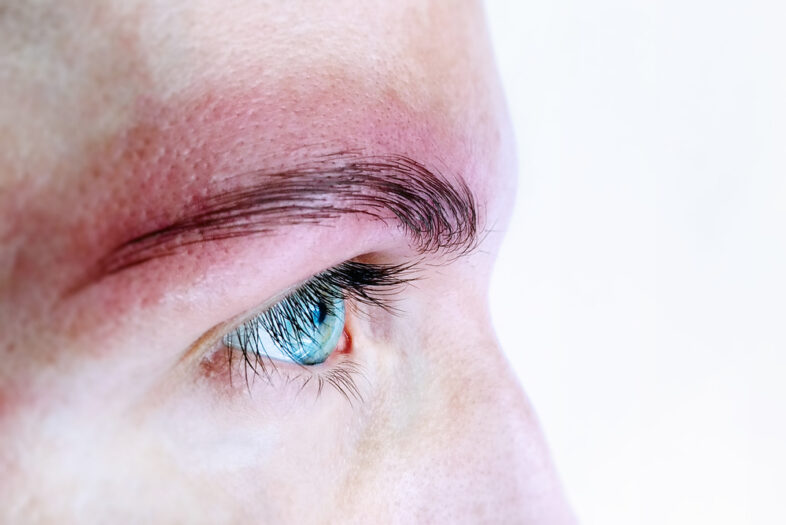 Complicaties van tatoeages en permanente make-up