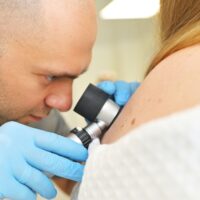A,Dermatologist,Oncologist,Uses,A,Dermatoscope,To,Examine,Moles,And
