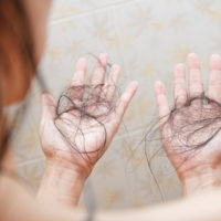 Hair,Falling,Out,In,Two,Hands,After,Rinse,Off,Shampoo.
