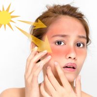 Zon en Huid -Titel